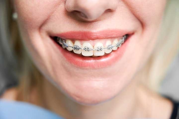 Ipacsa Dental Inicio